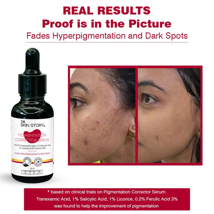 Anti - Pigmentation Combo - The Skin Story - Face Care